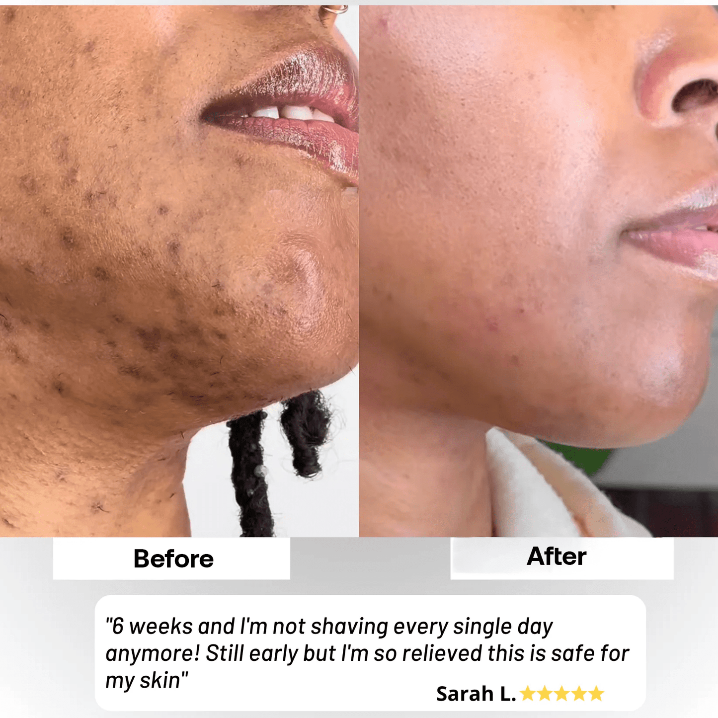 Skyn Hair Removal Serum